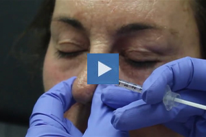 Injectable Nose Job - Dr. Kenneth Beer