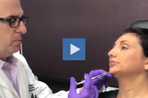 Voluma Injection of the chin - Dr. Kenneth Beer